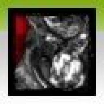 ������5���ɾ��б�