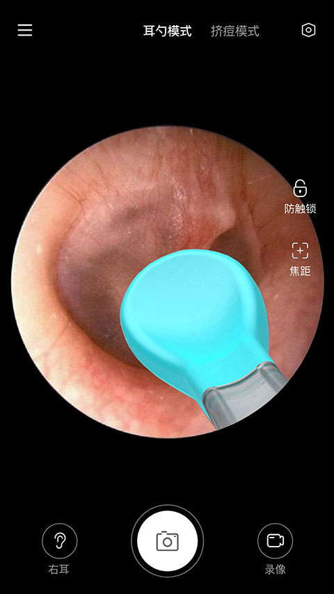 Xlife���Ӷ��װ�װ����v1.0.60��׿���ͼ1