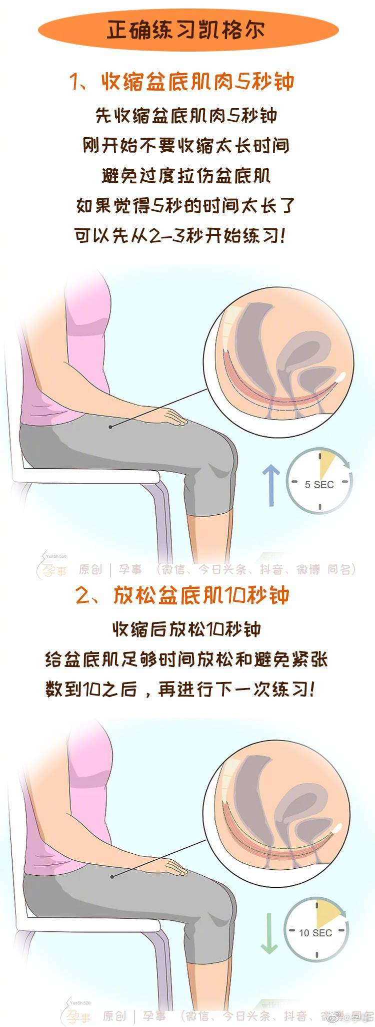 凯格尔训练效果自查与盆底肌评估配图