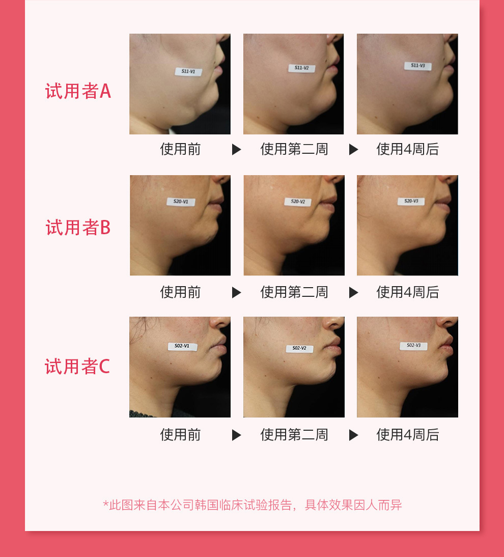 ZIIP Beauty΢����ģʽ ��������� ��ˮ�� ʵ��Ч��