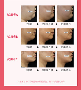 ZIIP Beauty΢����ģʽ ��������� ��ˮ�� ʵ��Ч��
