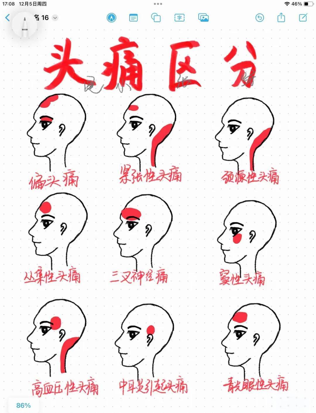 悟空头很疼 悟空头疼原因与缓解方法全解析 游戏动漫剧情表现与玩家实际体验