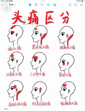 悟空头很疼 悟空头疼原因与缓解方法全解析 游戏动漫剧情表现与玩家实际体验