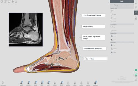 Complete Anatomy for Mac电脑版截图2