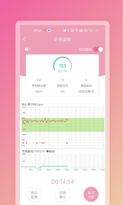 Fetaphon Home共享相册功能