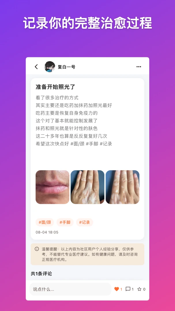 小白岛-白癜风病友互助交流社区1.0.0安卓版截图1