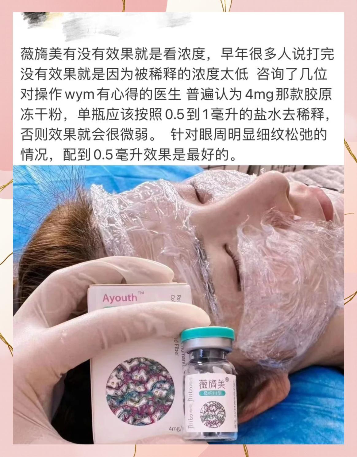 薇伊美V值不值得入手 薇伊美V真实用户反馈汇总
