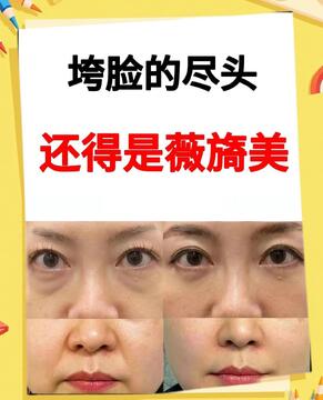 薇伊美V入手避坑指南 薇伊美V正确使用方法与注意事项